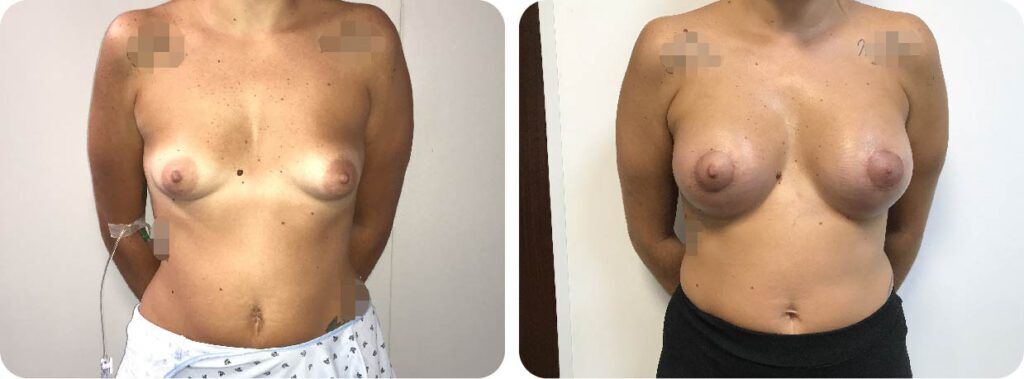 mamas-tuberosas-1-10-1024x379